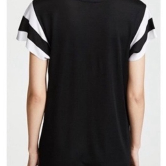 Rag & Bone Black and White Penny Dress - Picture 3 of 6